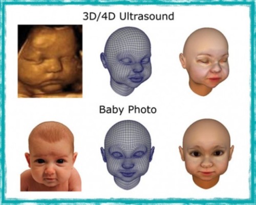 3D-Fetus1-620x496